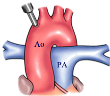 Sebelum Operation
